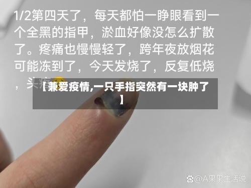 【兼爱疫情,一只手指突然有一块肿了】